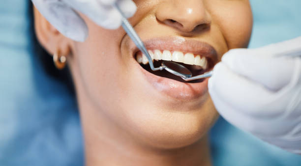 Best Emergency Root Canal Treatment in Mans, CO